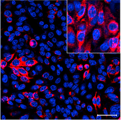 Cabbage exosome DNA delivery.